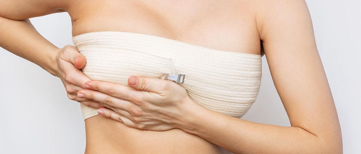 Quem tem direito à cirurgia de reconstrução mamária